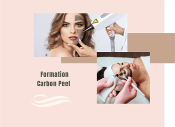 Formation Carbon Peel